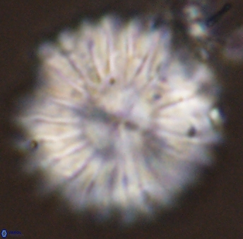 Discoaster multiradiatus 44306
