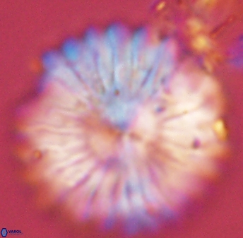 Discoaster multiradiatus 44307