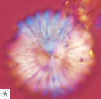 Discoaster multiradiatus 44307