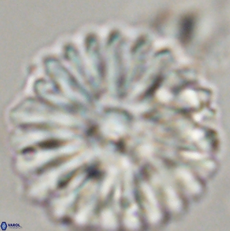 Discoaster multiradiatus 44308
