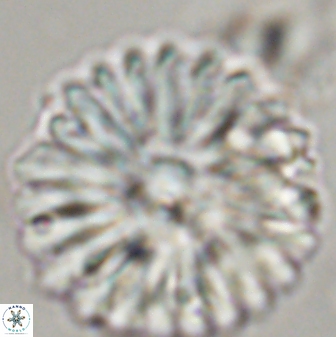 Discoaster multiradiatus 44308