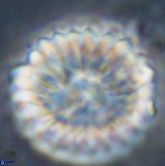 Discoaster multiradiatus 44309