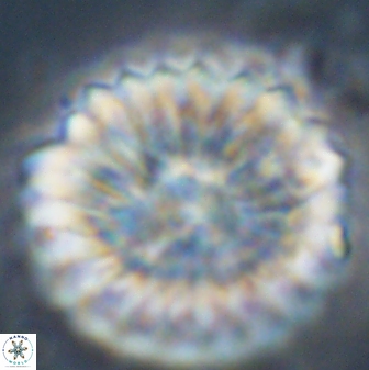 Discoaster multiradiatus 44309