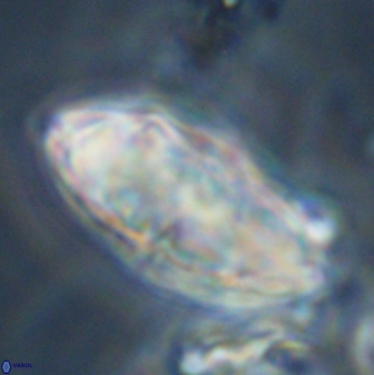Discoaster multiradiatus 44310