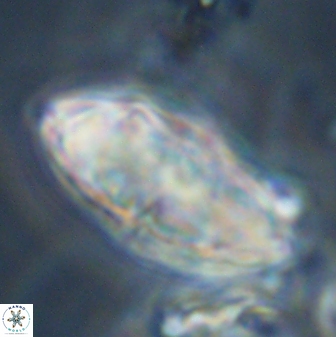 Discoaster multiradiatus 44310
