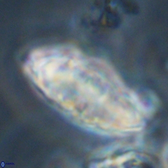 Discoaster multiradiatus 44311