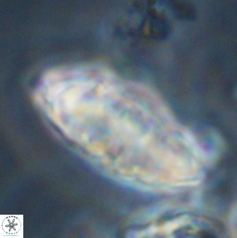Discoaster multiradiatus 44311