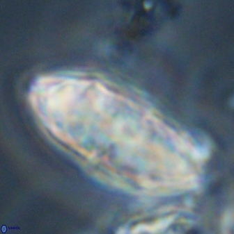 Discoaster multiradiatus 44312