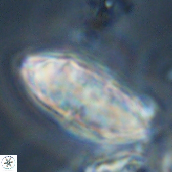 Discoaster multiradiatus 44312