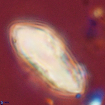 Discoaster multiradiatus 44314