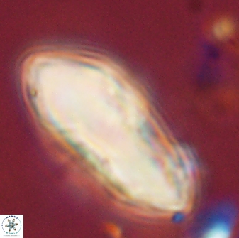 Discoaster multiradiatus 44314