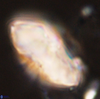 Discoaster multiradiatus 44315