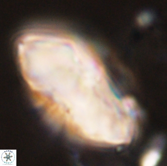 Discoaster multiradiatus 44315