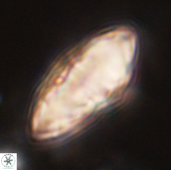 Discoaster multiradiatus 44317