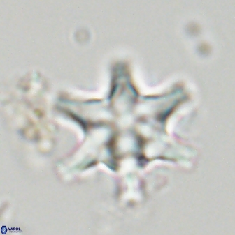 Discoaster musicus 32722