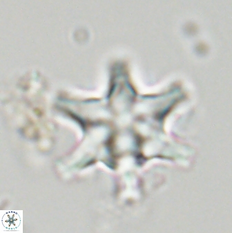 Discoaster musicus 32722