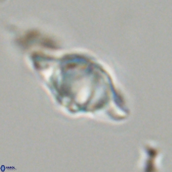 Discoaster musicus 32725