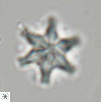 Discoaster musicus 32727