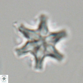 Discoaster musicus 32729