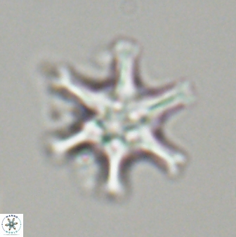 Discoaster musicus 32730