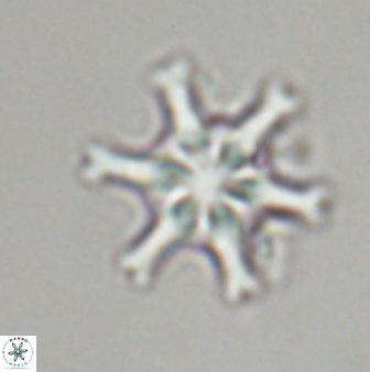 Discoaster musicus 32735