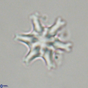 Discoaster musicus 32736