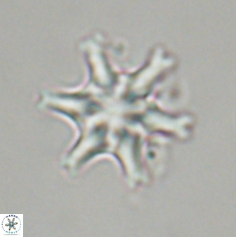 Discoaster musicus 32736