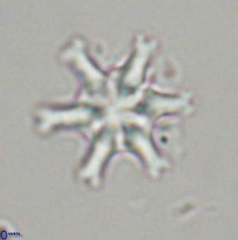 Discoaster musicus 32740