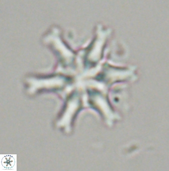 Discoaster musicus 32740