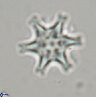 Discoaster musicus 32741