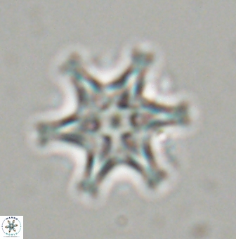 Discoaster musicus 32743