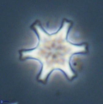 Discoaster musicus 32745