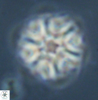 Discoaster musicus 32749