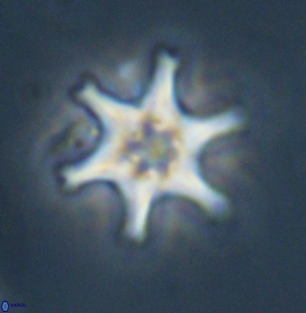 Discoaster musicus 32751