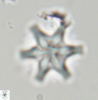 Discoaster musicus 32754
