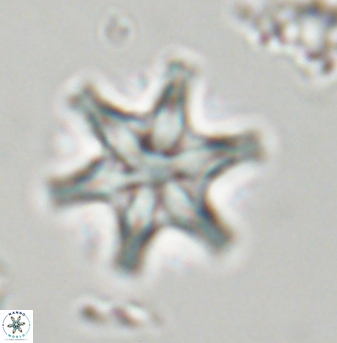 Discoaster musicus 32757