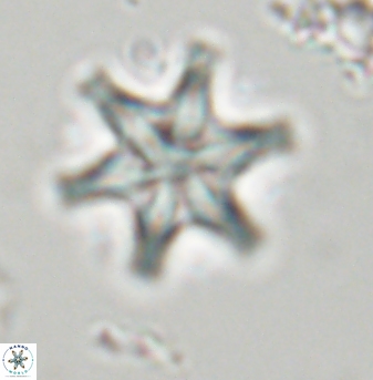 Discoaster musicus 32759