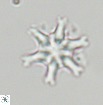 Discoaster musicus 32761