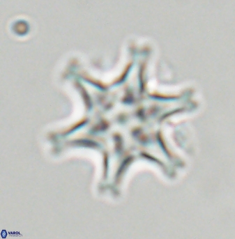 Discoaster musicus 32762