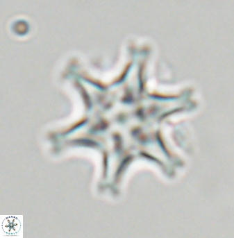 Discoaster musicus 32762