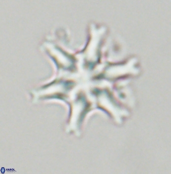 Discoaster musicus 32763