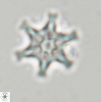 Discoaster musicus 32766