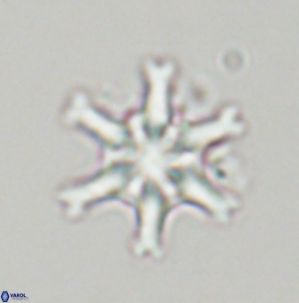 Discoaster musicus 32767