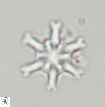 Discoaster musicus 32767