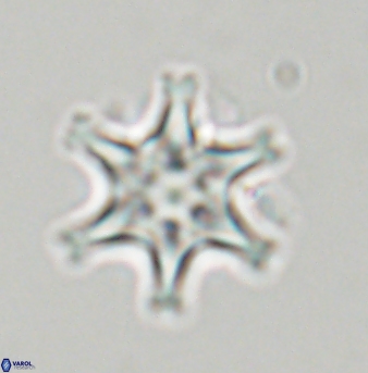 Discoaster musicus 32768