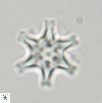 Discoaster musicus 32768