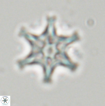Discoaster musicus 32769