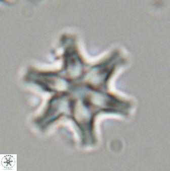 Discoaster musicus 32779