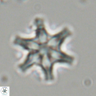 Discoaster musicus 32781