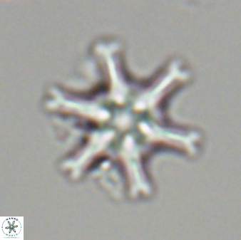 Discoaster musicus 32785